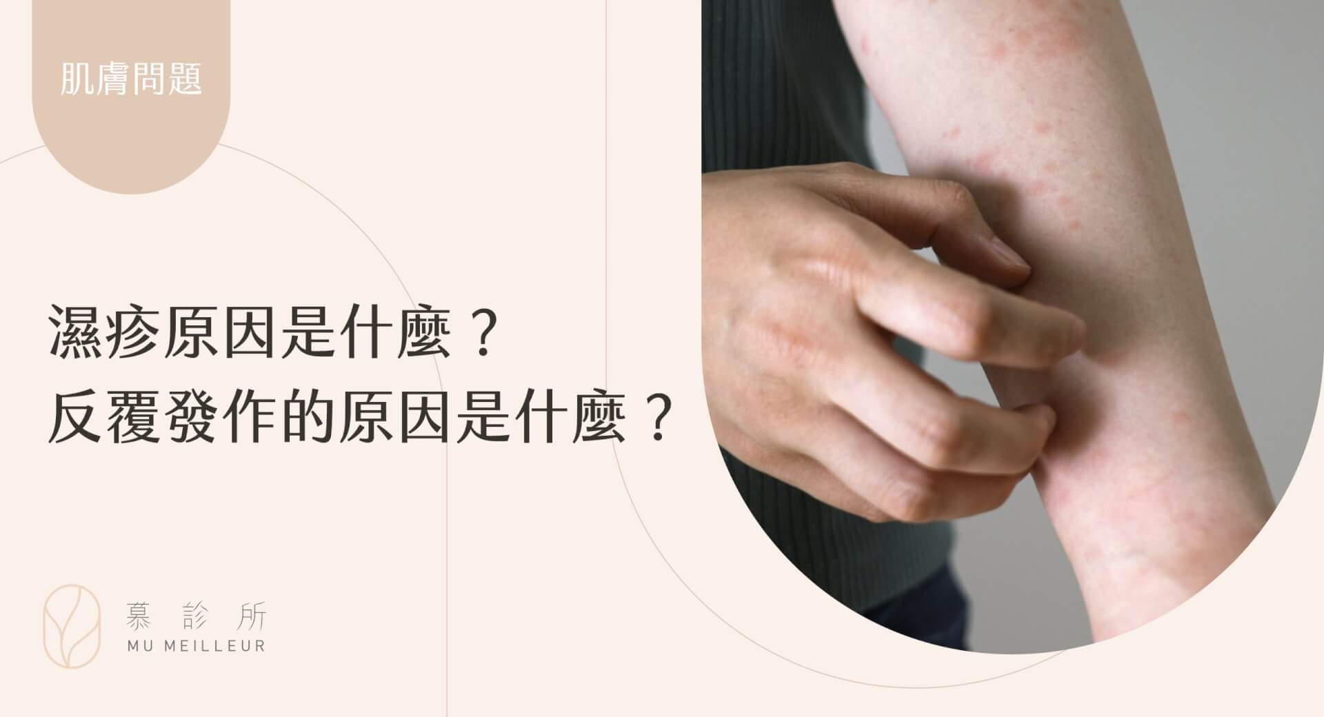 濕疹原因是什麼？反覆發作的原因是什麼？封面